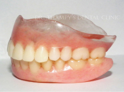 Dentures